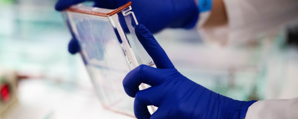 A gloved person handling a batch of lab samples.
