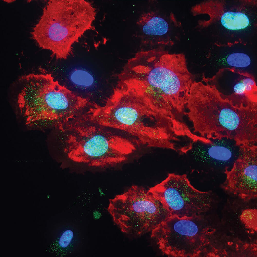 Perineurial cells form the peripheral nerve-extrafascicular tissue barrier