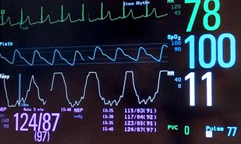 Vital Signs Monitor Vital Signs Monitor