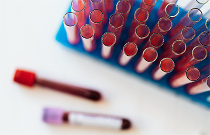 Vials of blood Vials of blood