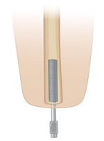 Osseointegration