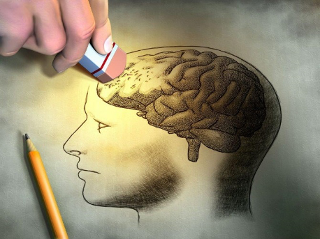 Drawing of brain being erased
